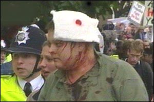 A bloodied pro-hunt supporter after clashes with police outside parliament